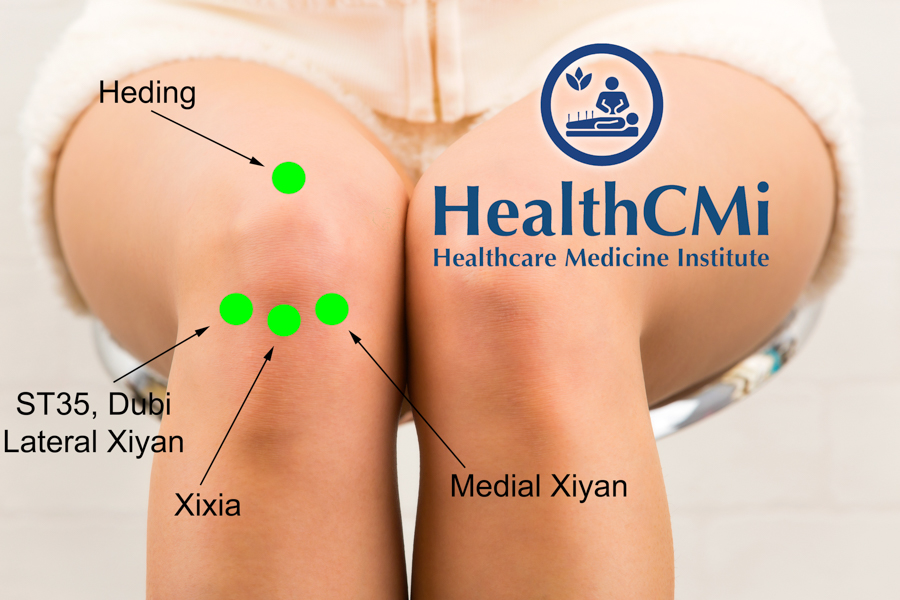 healthcmi acupuncture knee oa