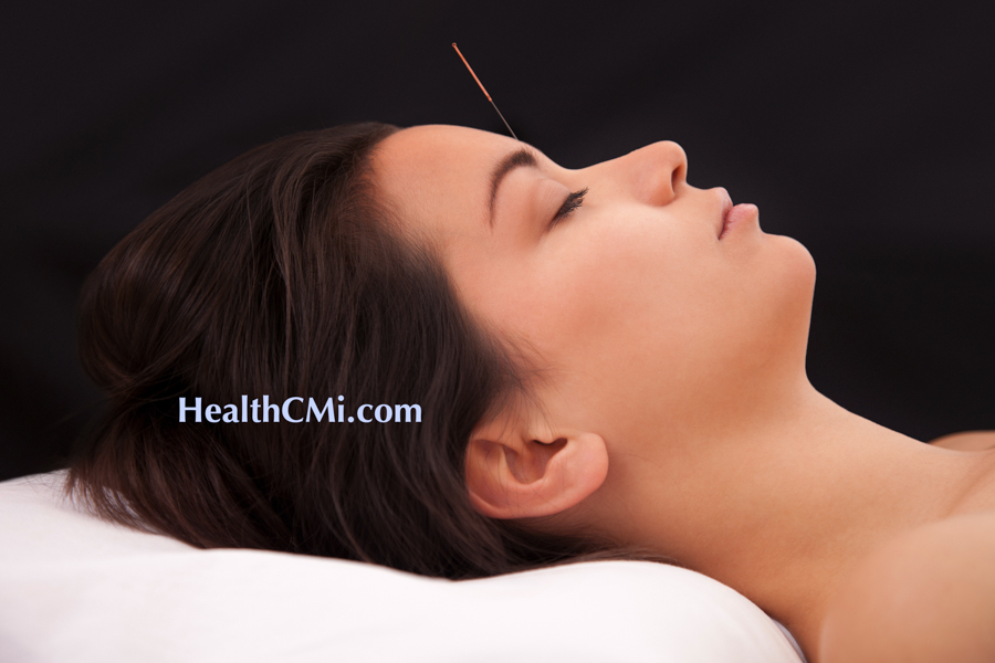 healthcmi yintang acupuncture ar