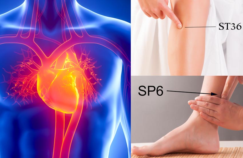 acupuncture st36 sp6 angina
