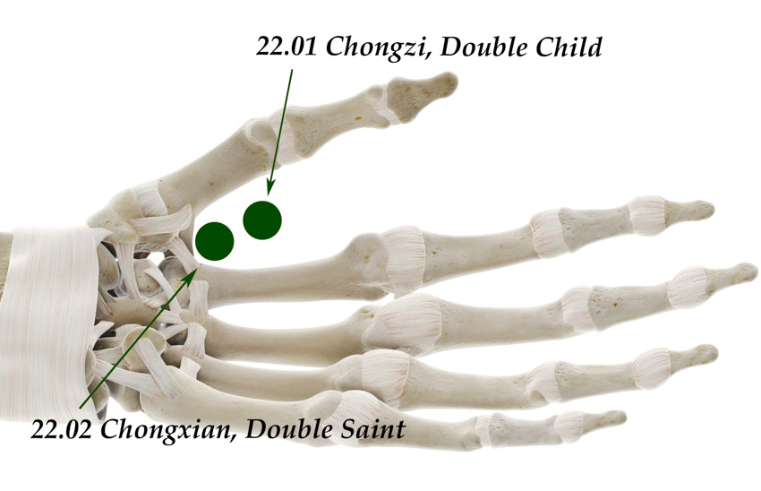 Acupuncture for Hand Paralysis And Spasticity