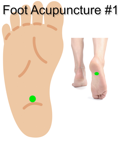 Foot Acupuncture 1