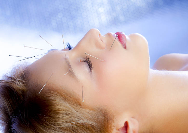 Scalp and face acupuncture