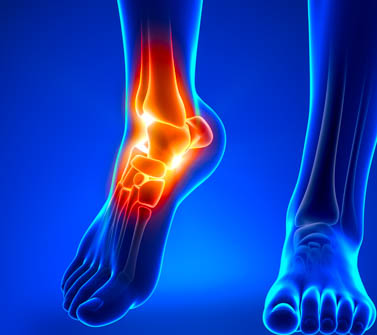 Ankle injuries treated with KD10 and Ahshi acupoints. 