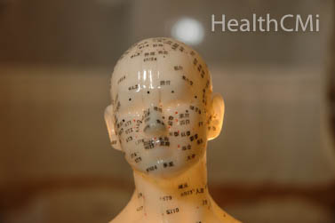 Head and scalp acupuncture. 