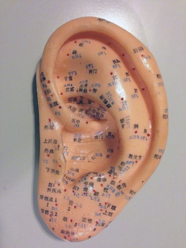 Auricular acupuncture points shown on an ear model. 