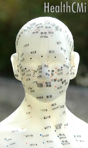 Facial points on an acupuncture doll. 