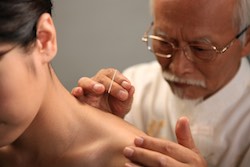 Example of acupuncturists needling a patient. 
