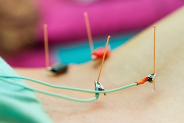 Lower back acupoints with electroacupuncture stimulation at BL channel points. 