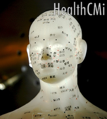 This photo depicts acupuncture points of the scalp on an model. 