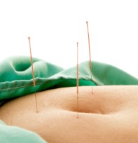 Acupoints are shown in this photo applied to the navel region. 