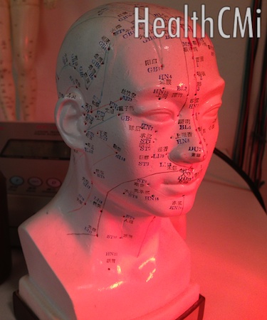 Scalp points are depicted in this plastic model near a red heat lamp. 