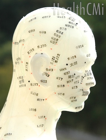 This new finding demonstrates the physical existence of acupuncture points. 