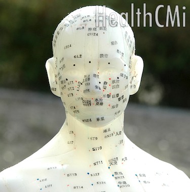Electro-acupuncture is effective for pain reduction according to new MRI and biochemical measurements. 