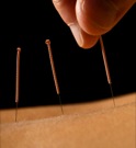 Acupuncture CEUs Online