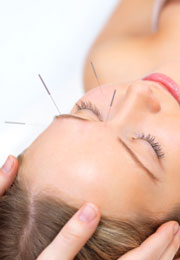 Acupuncture for the treatment of stroke is found effective.