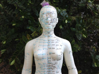 Acupuncture points are depicted in this photo. 
