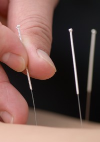 Acupuncture de-qi sensations turn out to be medically important. 