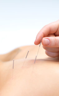 Back Shu point acupuncture is shown here. 