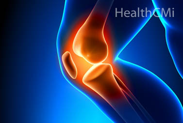 El dolor de rodilla es evocado por desgarro de menisco. 
