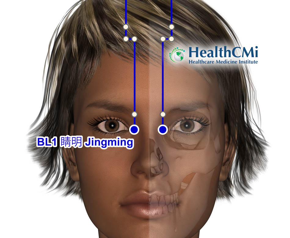 BL1 Jingming DEDi