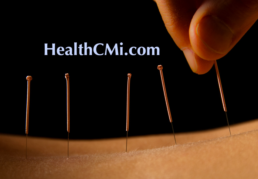 Florida Acupuncture CEBrokerCEs