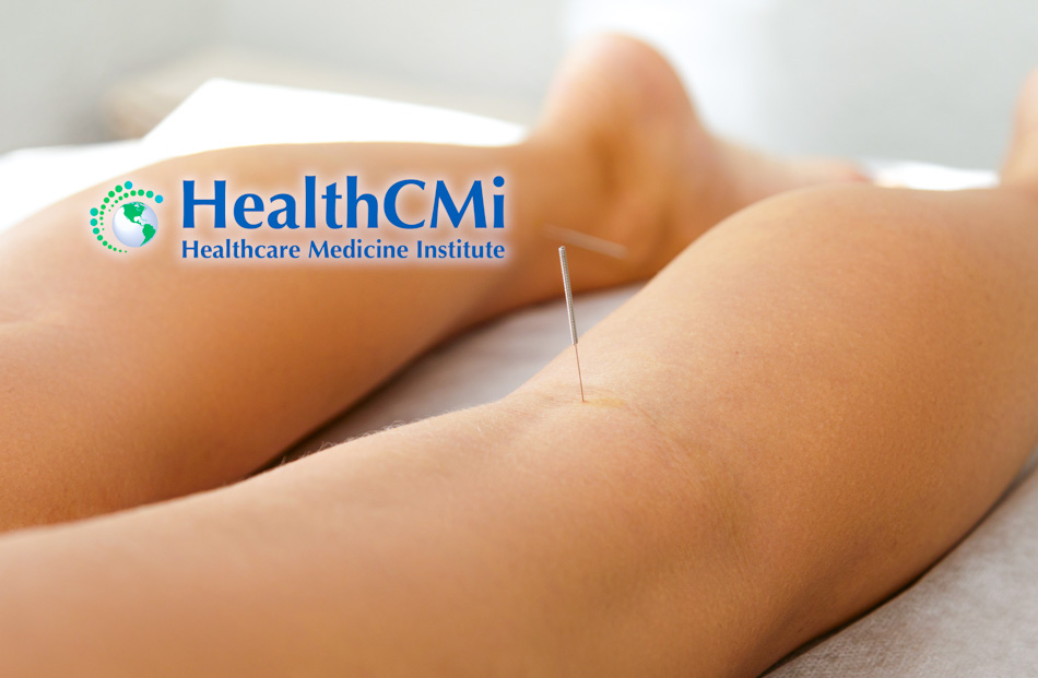 acupunctur bl40weizhon pt