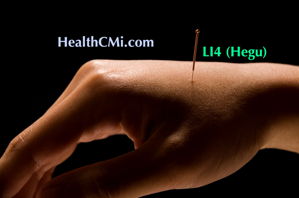 acupuncture LI4hegu ch25