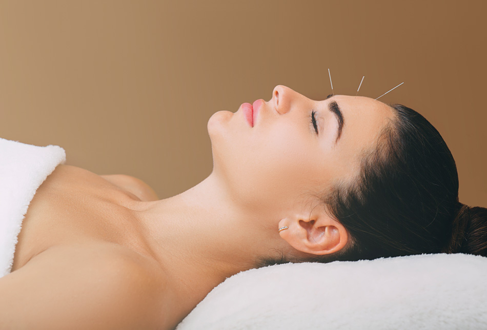 acupuncture alllergies confirm25