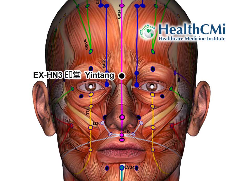 acupuncture antidepressant51325