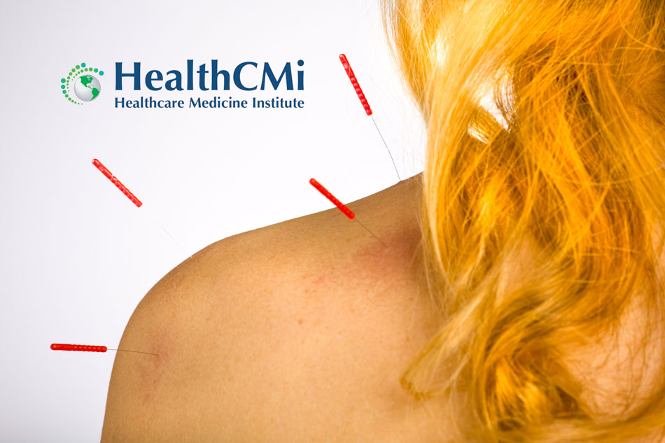 acupuncture autoimmune 24