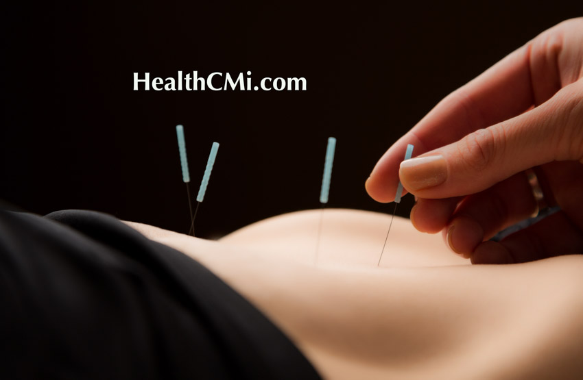 acupuncture ceu adenomyosis1aa