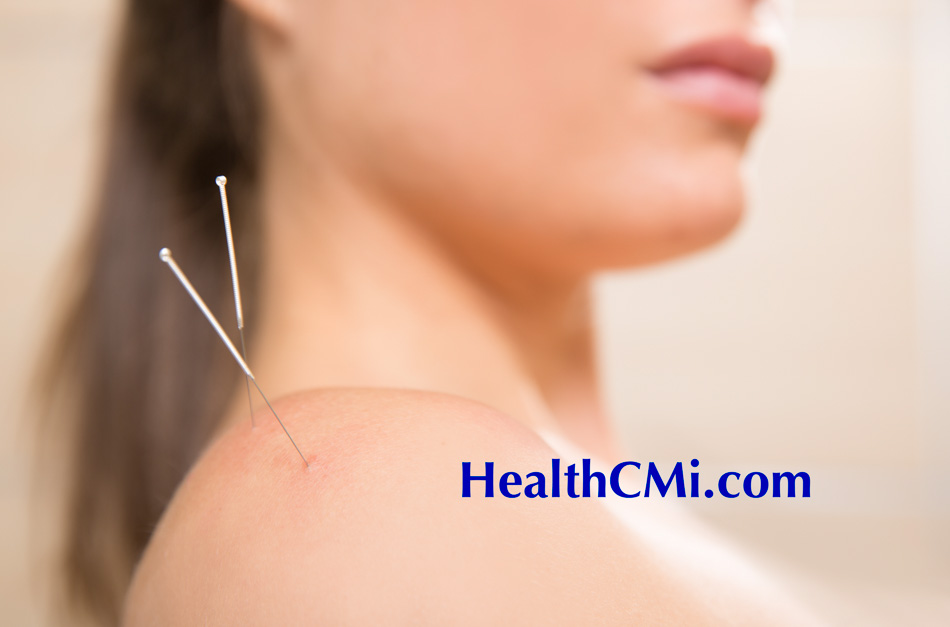 acupuncture ceu sis 25