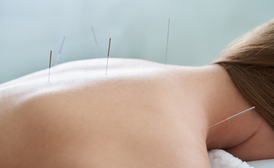 acupuncture immune system gene25