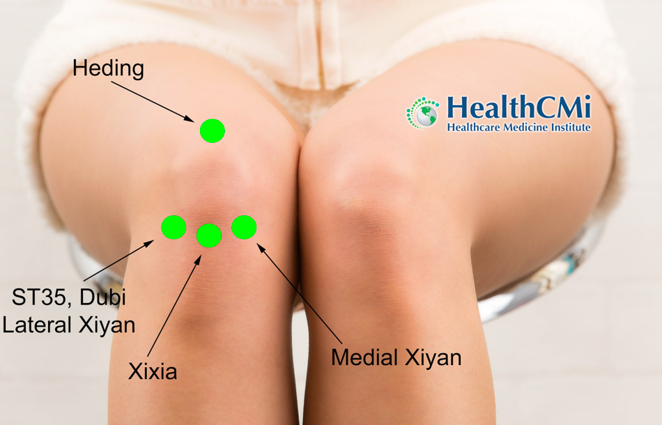 acupuncture knee RCT KOA