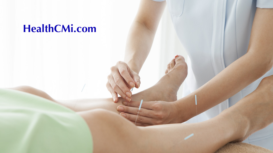 acupuncture knee xiyan24169