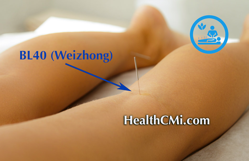 acupuncture sciaticafind24