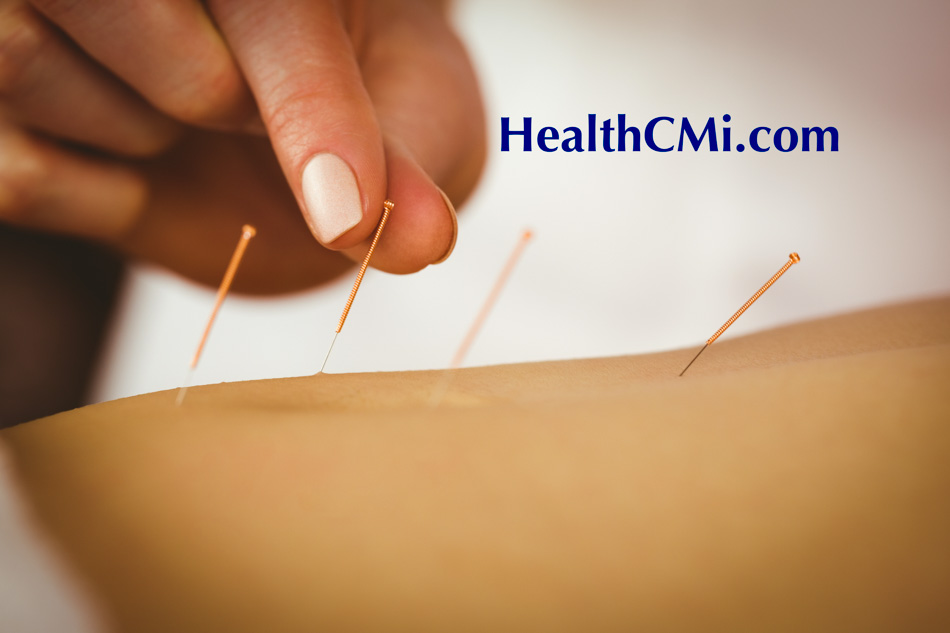 acupuncture st25 ibs 25