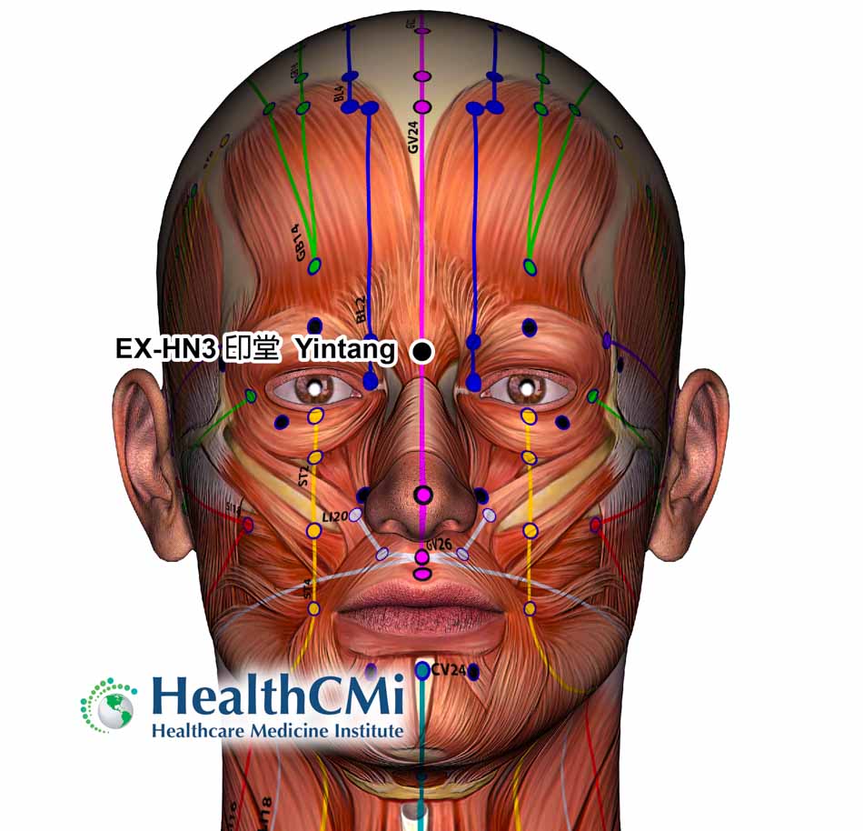 acupuncture yintang anxiety hama