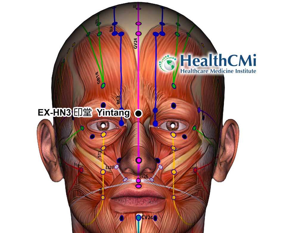 acupuncture112424parkinsonsdtx