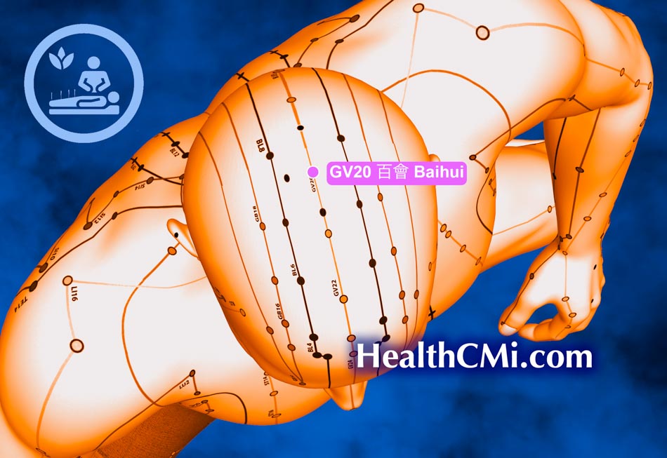 acupunctureanxiety12424