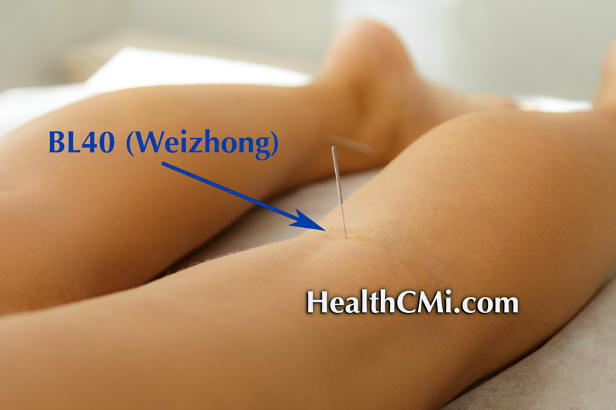 acupuncturebl40weizhong