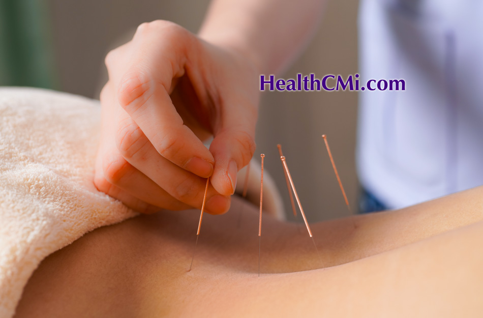 acupuncturelowbackpain241011