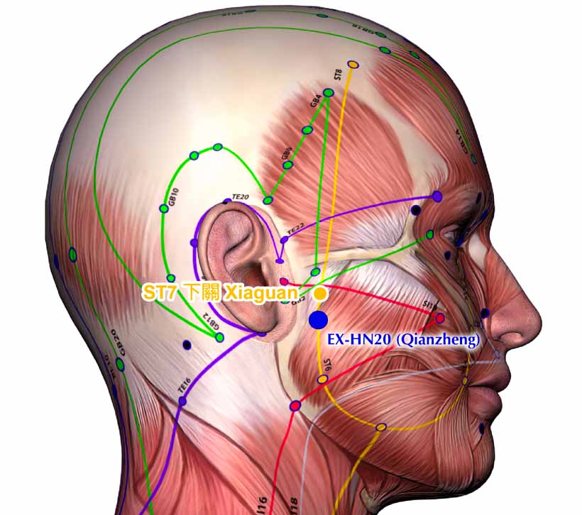 acupunctureqianzhenghn20