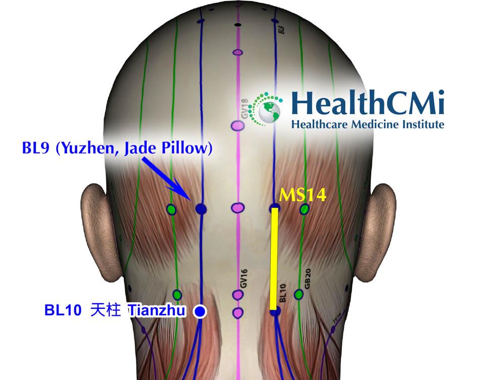 healthcmi MS14scalp