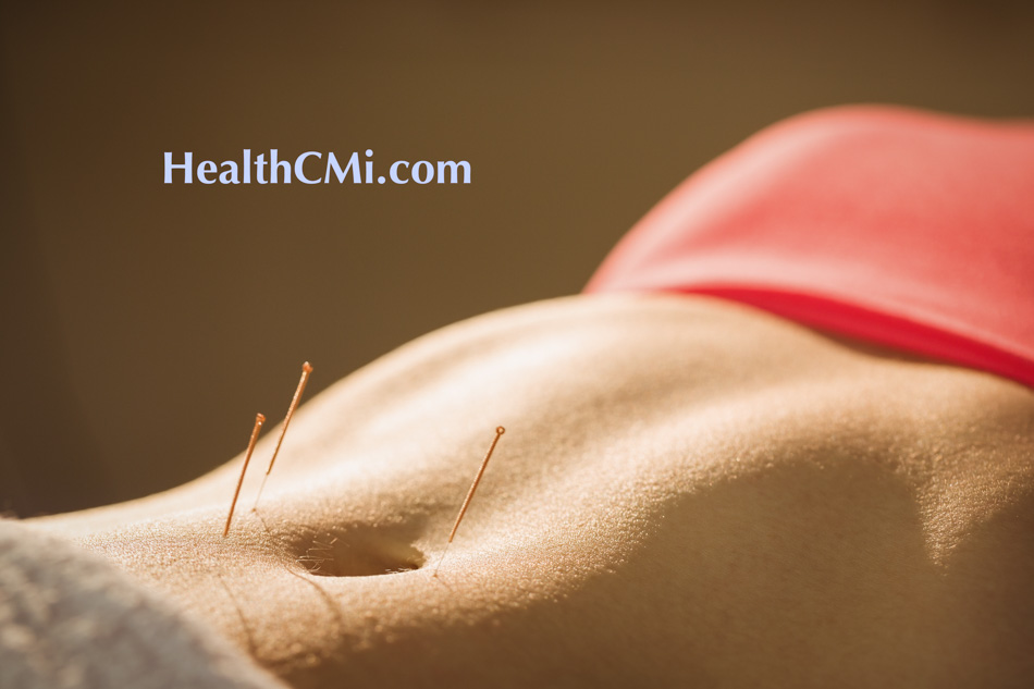 healthcmi ivf acupuncture25