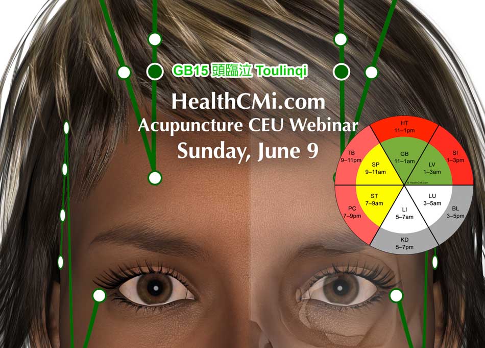 healthcmiacupuncture6924