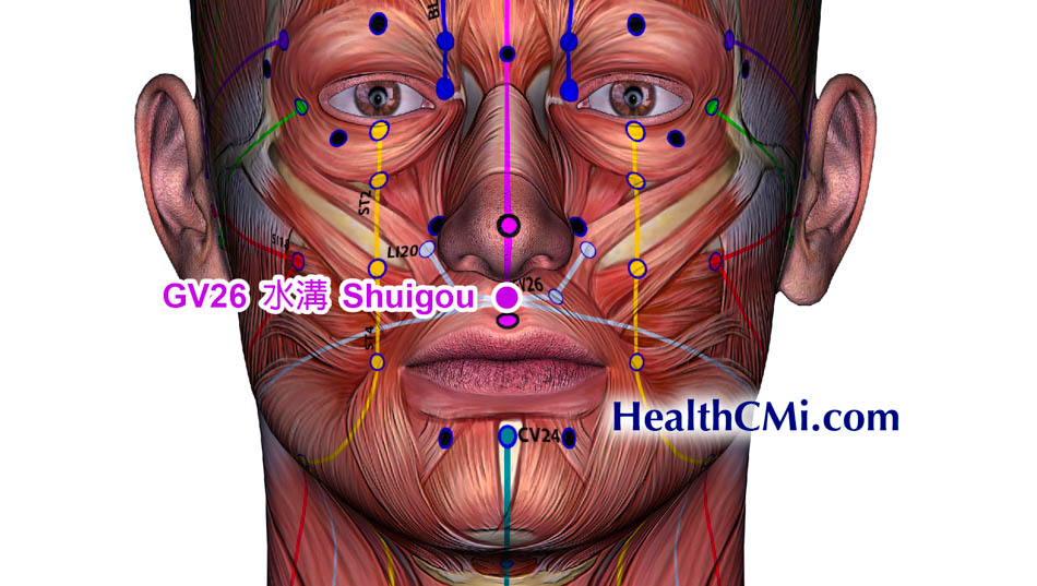 healthcmiacupuncturegv26stroke