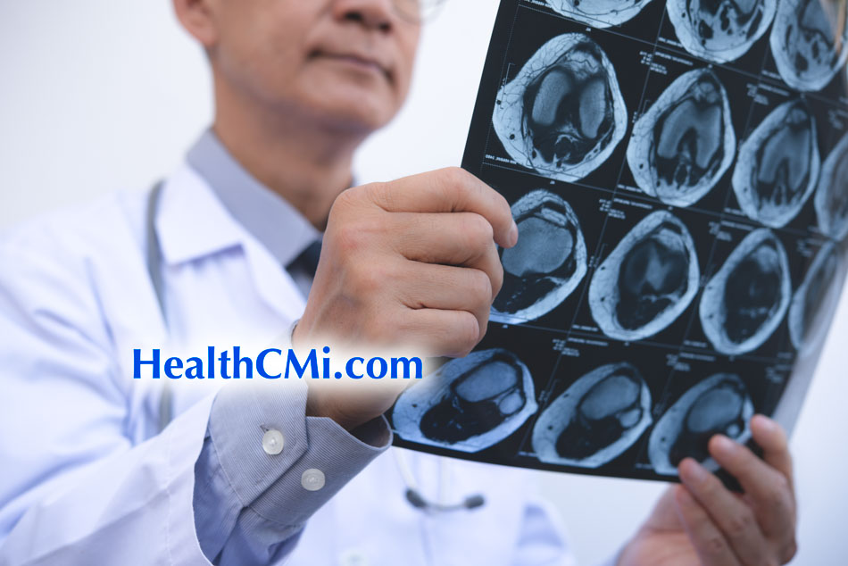 healthcmikneeoast36
