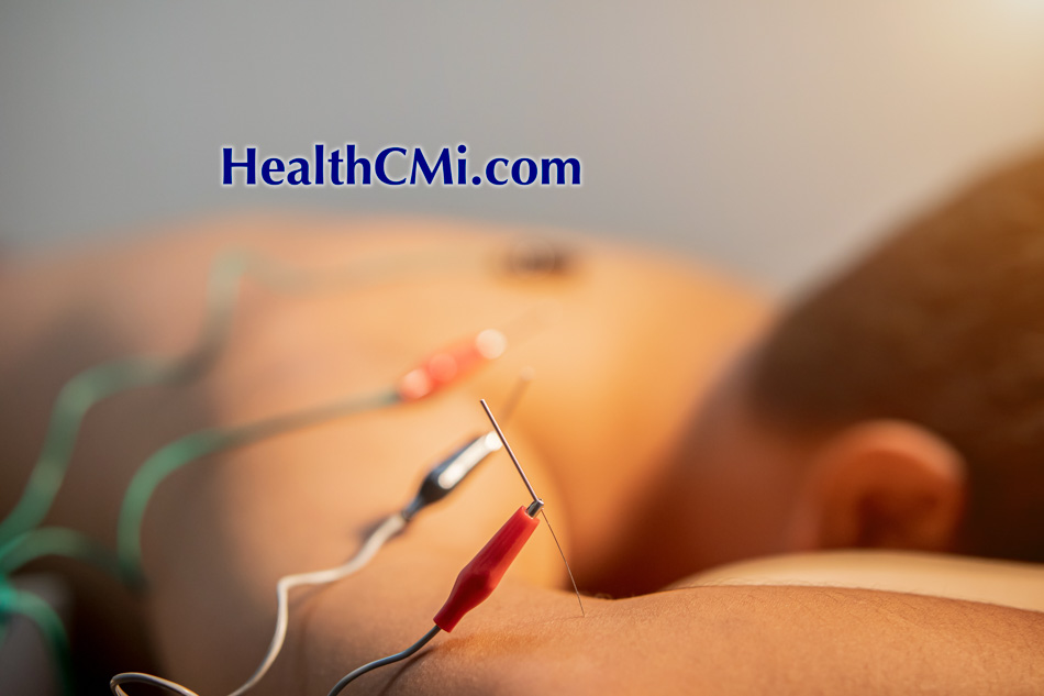 healthcmitcmschoolsacupuncture