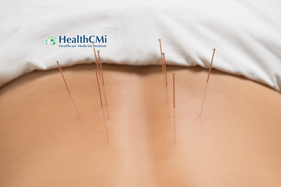 jiaji acupuncture hrealthcmi 25
